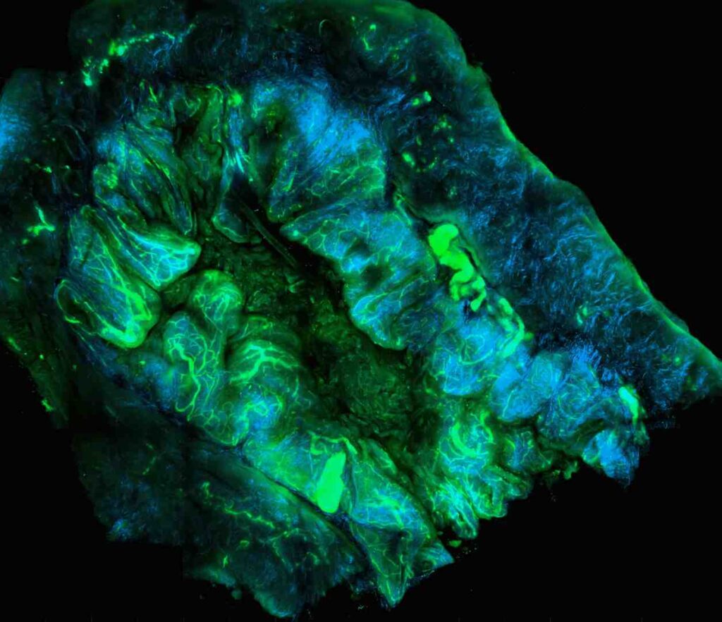 AI-powered biomarker discovery