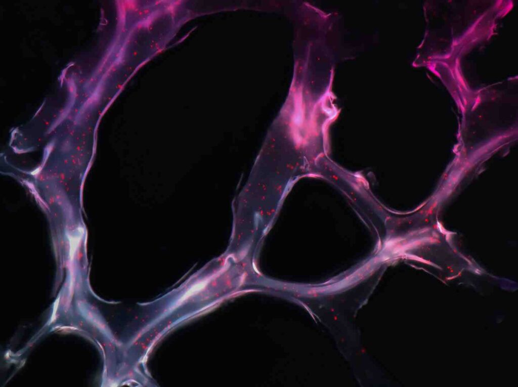 multi-omics