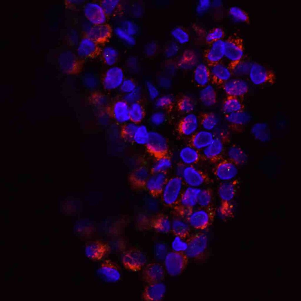 oncology data analytics