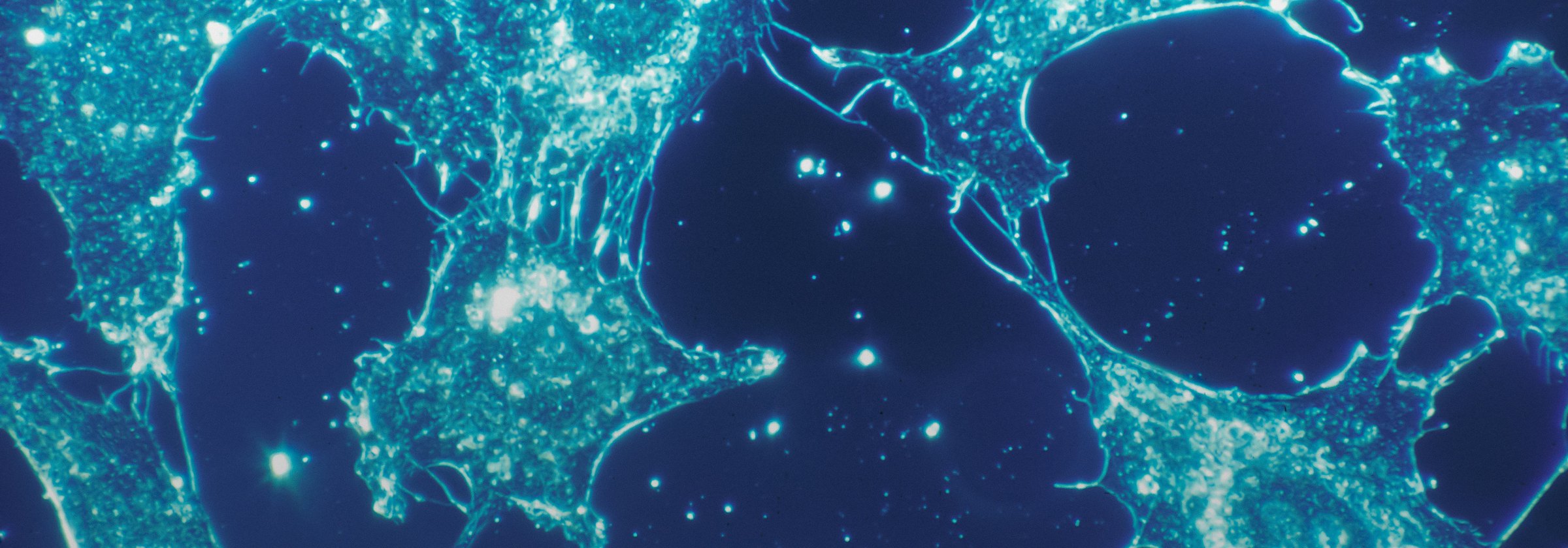 Fluorescence microscope image of human cells
