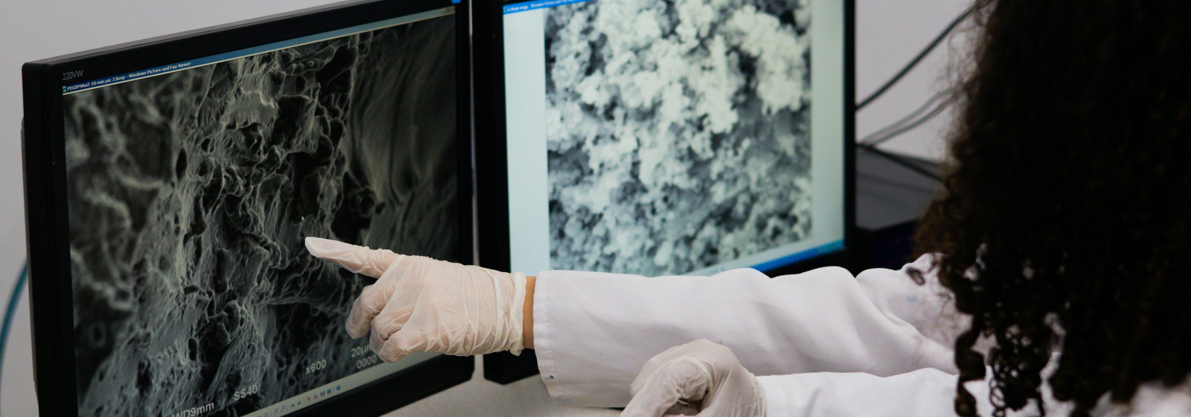 Researcher pointing at microscope images on two monitors